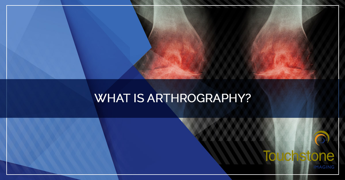 WHAT IS ARTHROGRAPHY?
