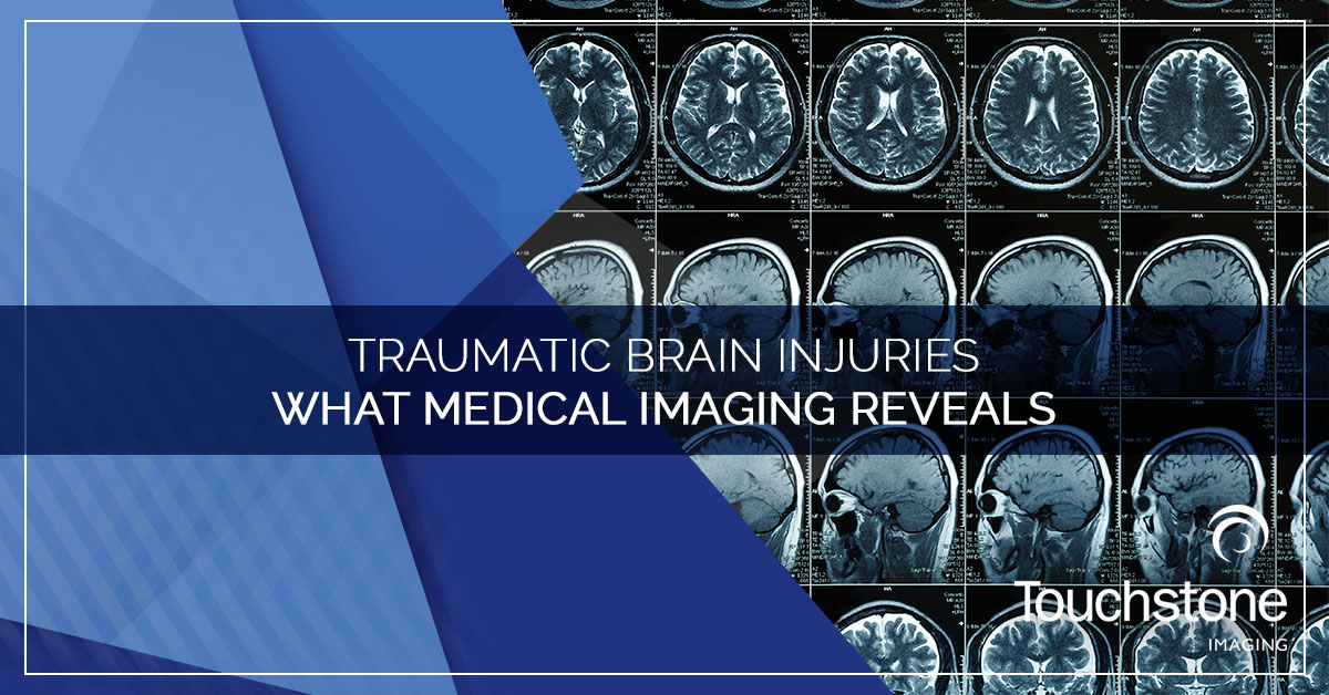 TRAUMATIC BRAIN INJURIES — WHAT MEDICAL IMAGING REVEALS