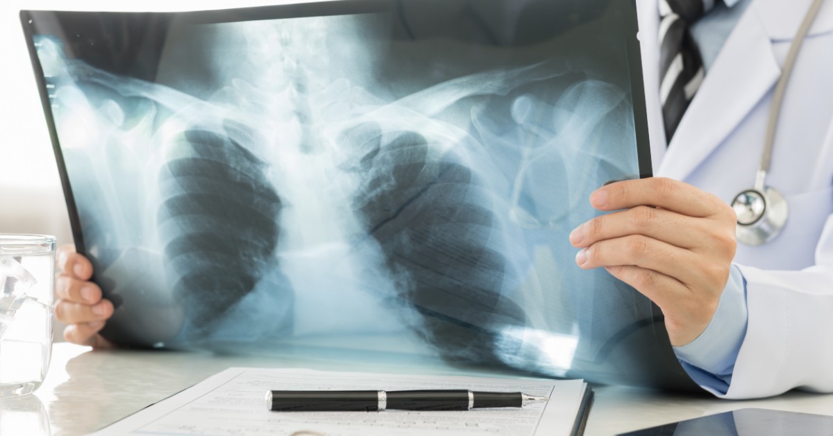 How X-Rays Work - X-Ray Near Me | Touchstone Medical Imaging