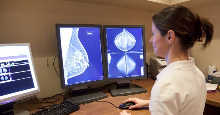 image of a woman looking at images of a breast ultrasound on computer screens in front of her