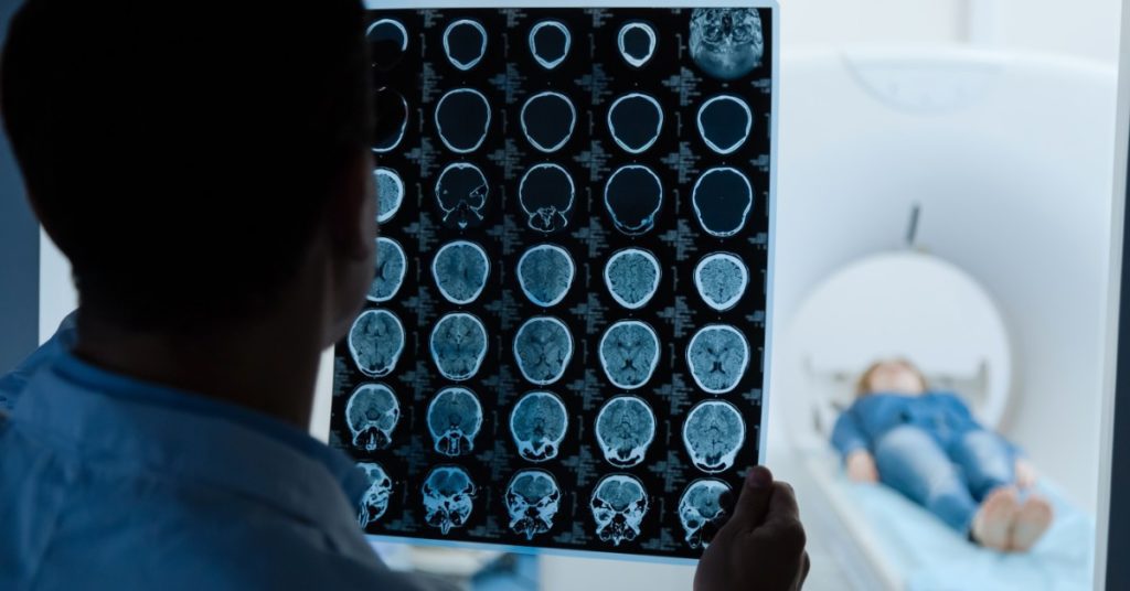 image of the back of a man holding CT scan images of a brain up. in the background, there is a woman in a CT machine