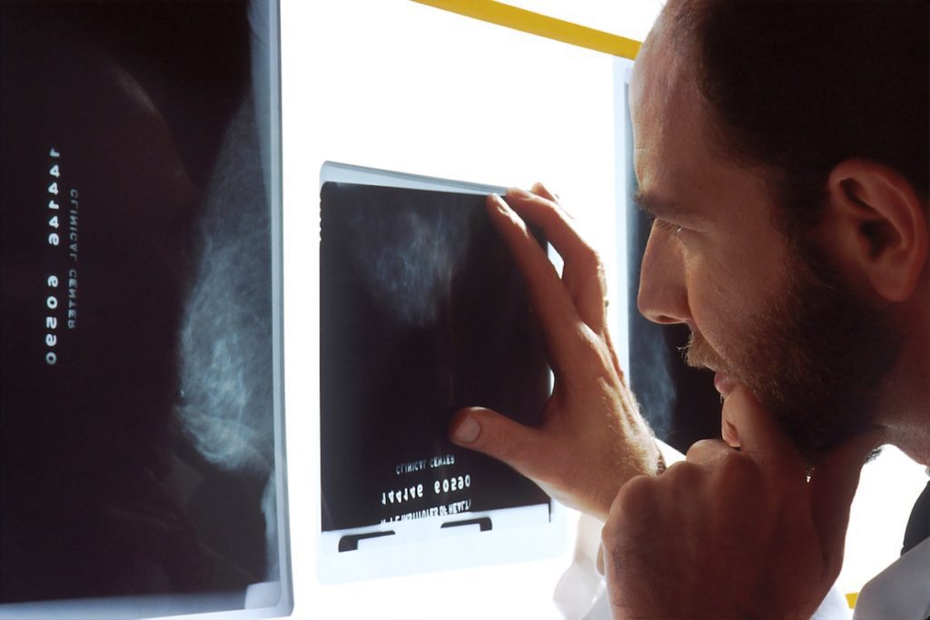 A medical imaging specialist looks at an X-ray printout. Photo by National Cancer Institute on Unsplash.