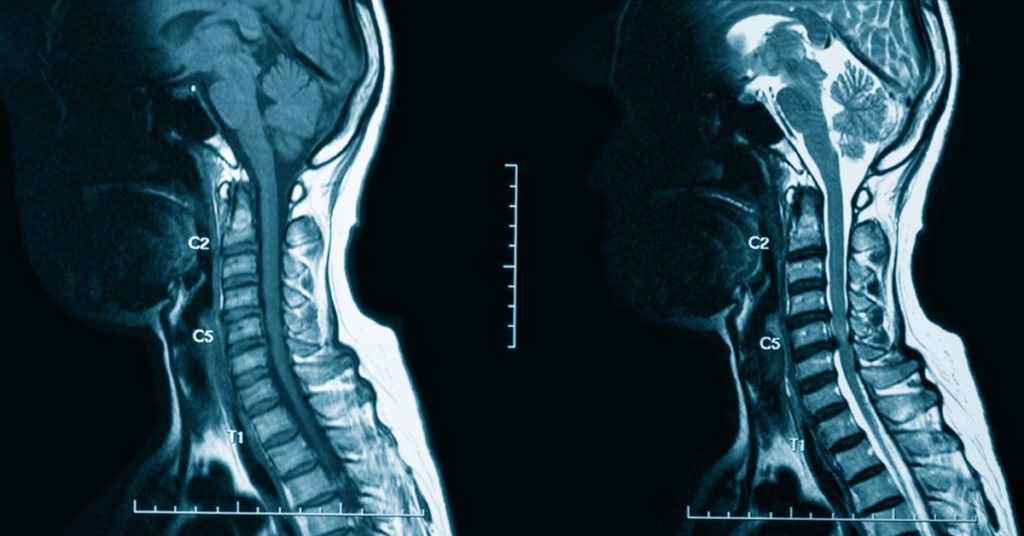 What You Need to Know: Navigating the Iodinated Contrast Media