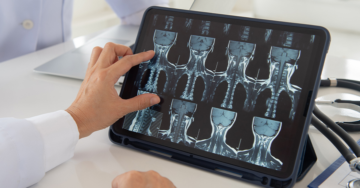 When to Get a Cervical Spine MRI for Text Neck