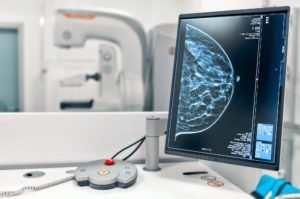 Screening Mammography