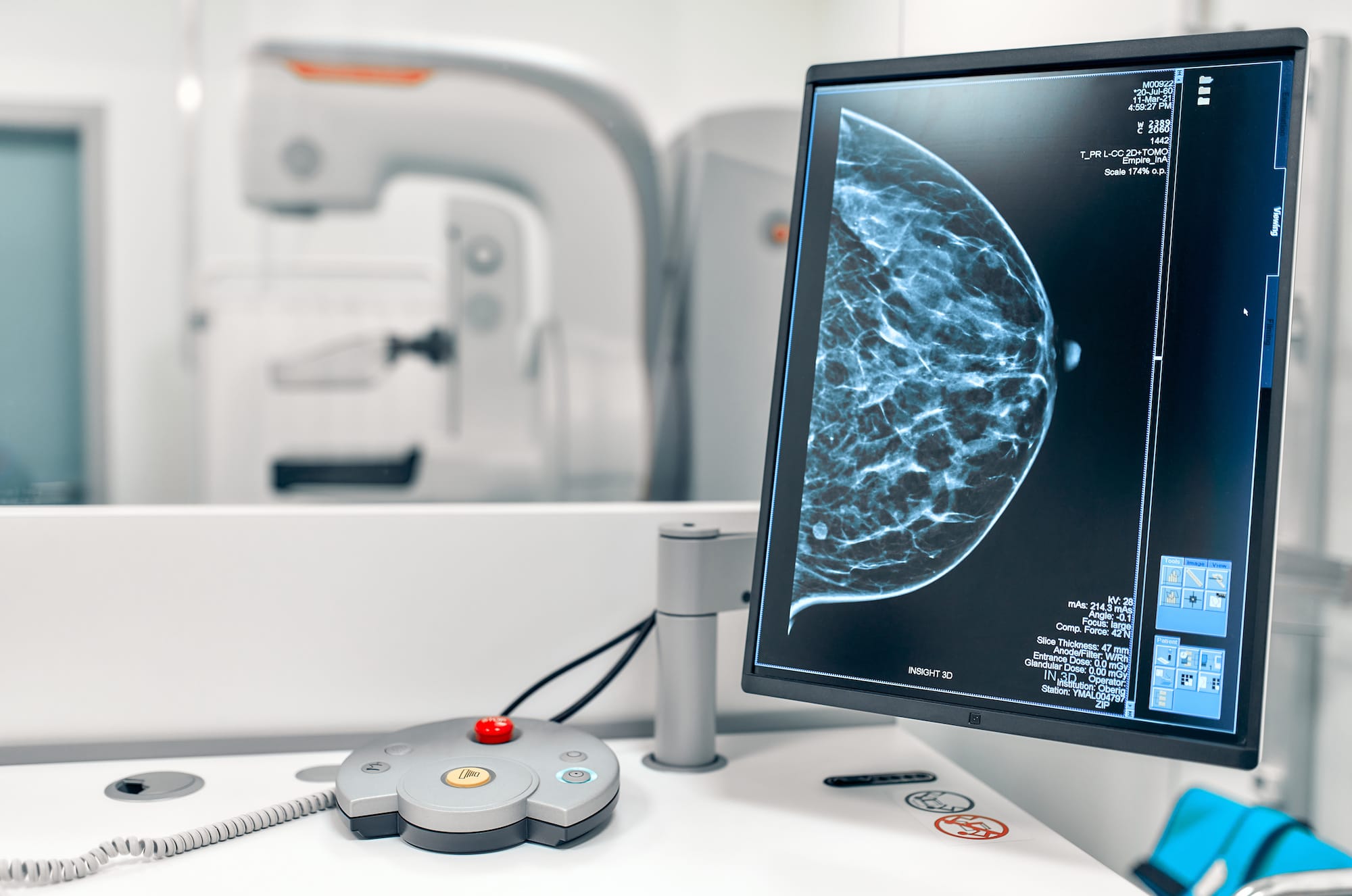 Why should I get my 3D screening mammogram at an imaging center instead