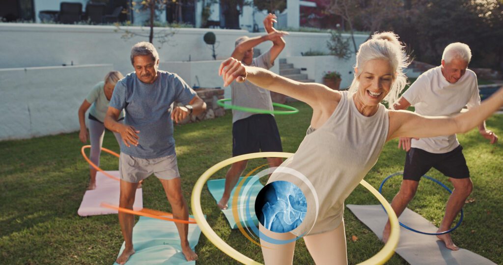 Woman with hip pain hula hooping. Needs a CT scan to identify pain.
