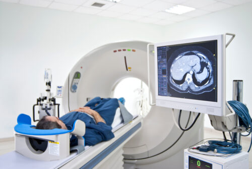 Why did my doctor order a CT scan of my abdomen and pelvis ...